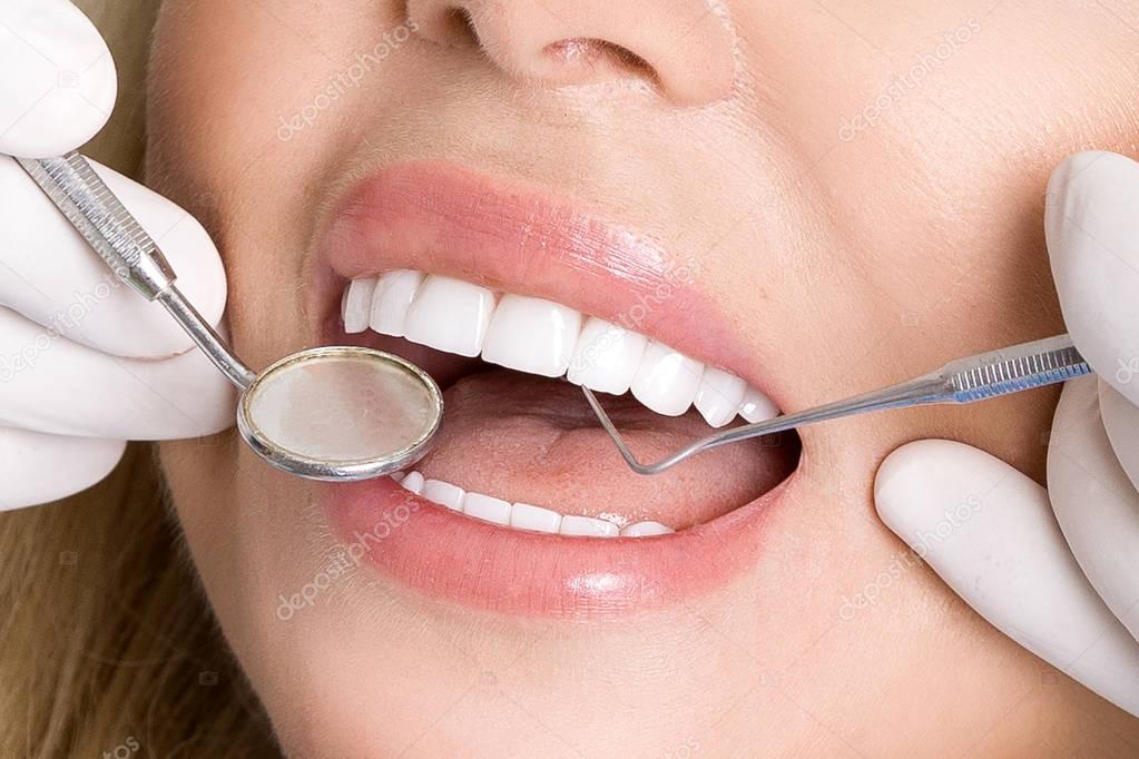 Sonrisa con carillas dentales estéticas