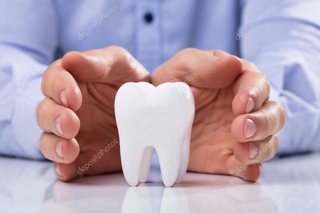 Representación de un implante dental unitario en la arcada
