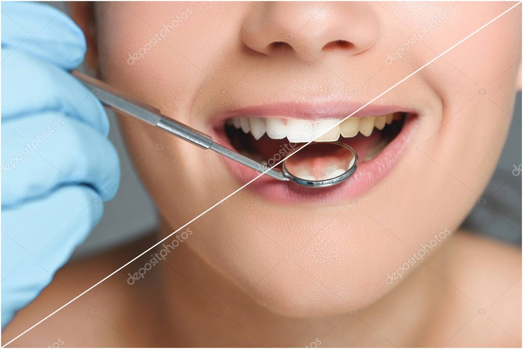 Paciente mostrando dientes más blancos tras blanqueamiento dental