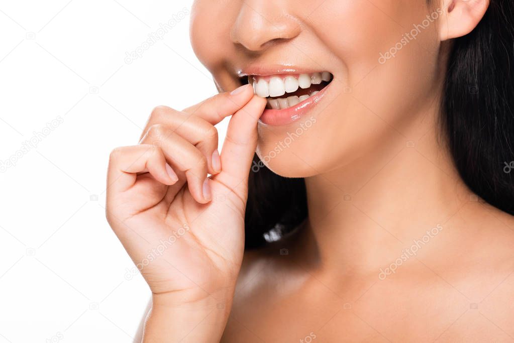 Primer plano de dientes con carillas dentales